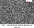 TGFBR2 Stably Over-Expressing LNCaP Cell Line (LNCaP-RII) | Applied Biological Materials (abm)