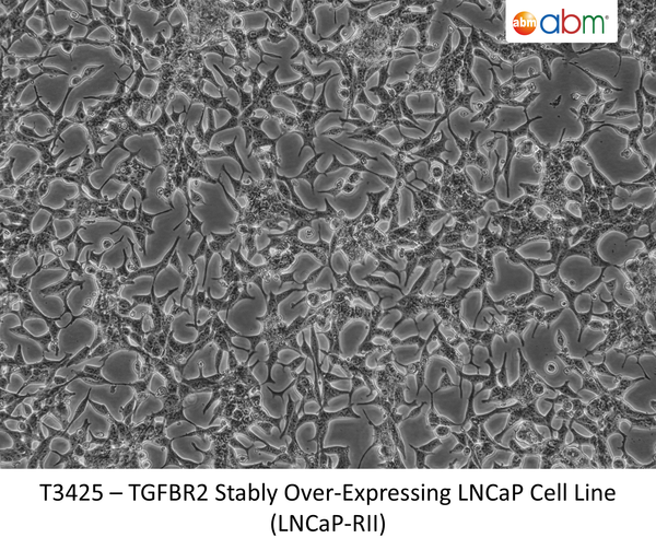 TGFBR2 Stably Over-Expressing LNCaP Cell Line (LNCaP-RII) | Applied Biological Materials (abm)