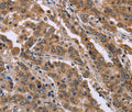 FAM3B Polyclonal Antibody – Figure 1 of 2