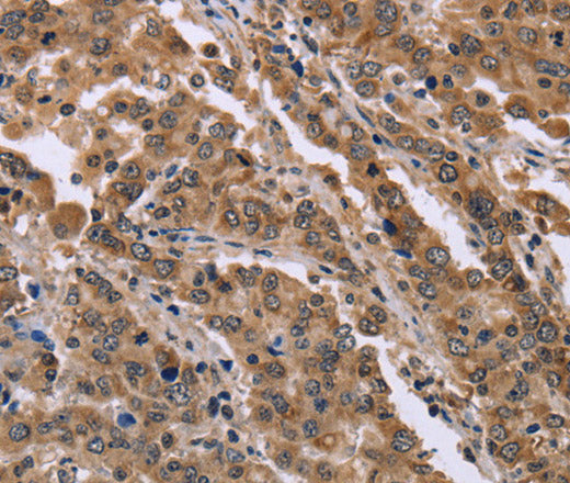 FAM3B Polyclonal Antibody – Figure 1 of 2