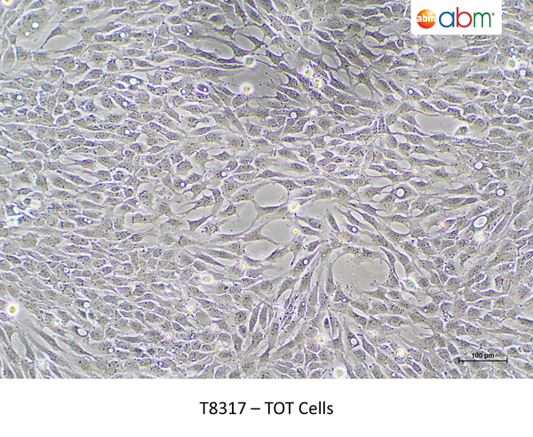 TOT Cells – Figure 1 of 1