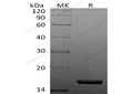 Recombinant Human TNF-alpha/TNFA Protein (His Tag) – Figure 1 of 2
