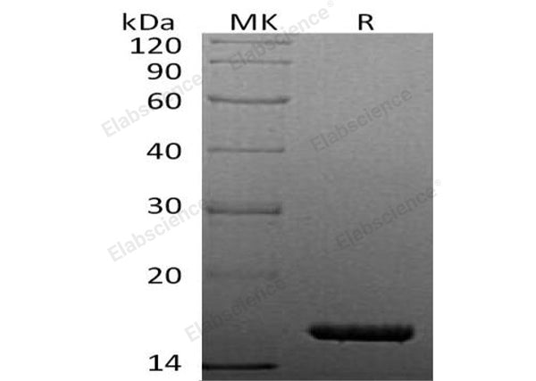 Recombinant Human TNF-alpha/TNFA Protein (His Tag) – Figure 1 of 2