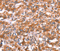 GAS8 Polyclonal Antibody – Figure 1 of 3