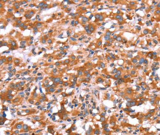 GAS8 Polyclonal Antibody – Figure 1 of 3