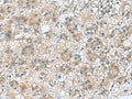 RAB39A Polyclonal Antibody – Figure 1 of 2