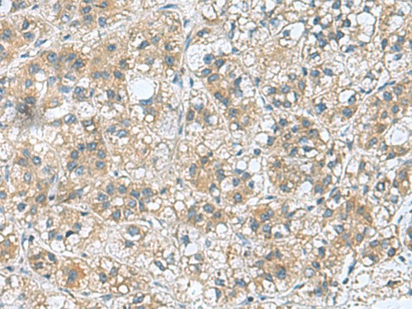 RAB39A Polyclonal Antibody – Figure 1 of 2