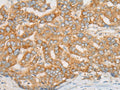 ATXN7 Polyclonal Antibody – Figure 1 of 3