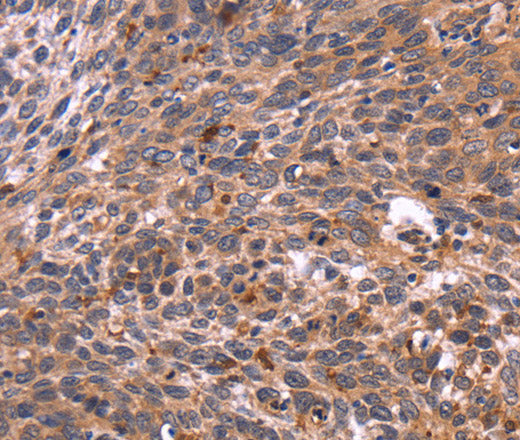 CRK Polyclonal Antibody – Figure 1 of 3