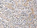 GMPR Polyclonal Antibody – Figure 1 of 2