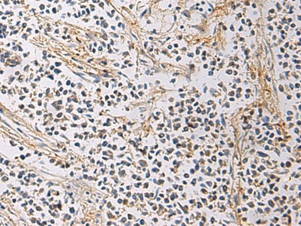 GMPR Polyclonal Antibody – Figure 1 of 2