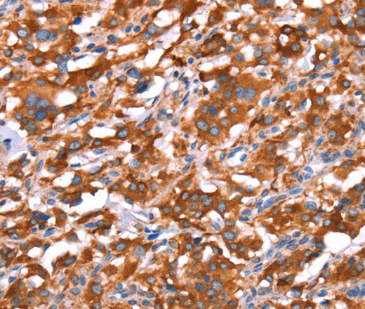 GAS8 Polyclonal Antibody – Figure 1 of 3