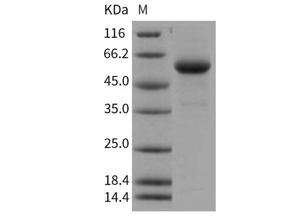 Recombinant Human Cathepsin C/CTSC/DPPI Protein (His Tag) – Figure 1 of 2