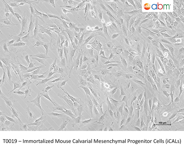 Immortalized Mouse Calvarial Mesenchymal Progenitor Cells (iCALs) – Figure 1 of 1