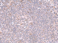 INPP5K Polyclonal Antibody – Figure 1 of 3