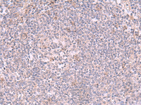 INPP5K Polyclonal Antibody – Figure 1 of 3