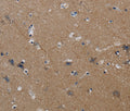 PIK3CG Polyclonal Antibody – Figure 1 of 2