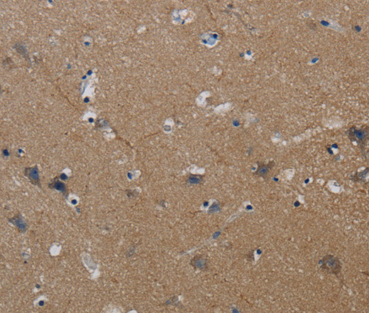 PIK3CG Polyclonal Antibody – Figure 1 of 2