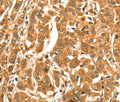 DIRAS1 Polyclonal Antibody – Figure 1 of 3