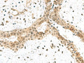 ELOC Polyclonal Antibody – Figure 1 of 3