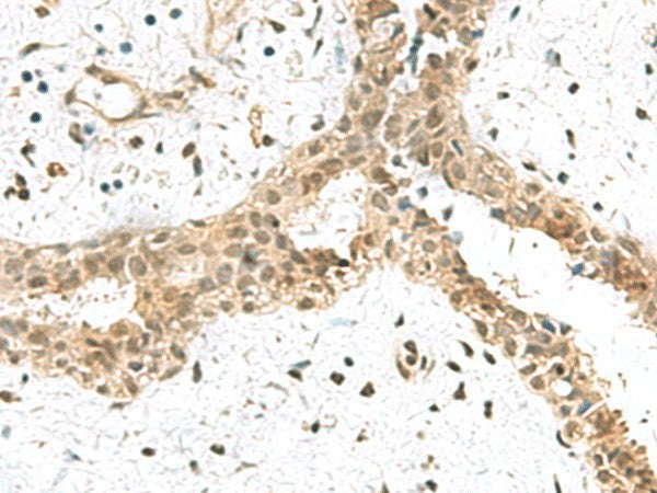 ELOC Polyclonal Antibody – Figure 1 of 3
