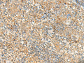 FKBP1A Polyclonal Antibody – Figure 1 of 2