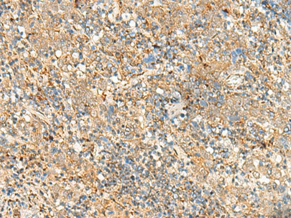 FKBP1A Polyclonal Antibody – Figure 1 of 2