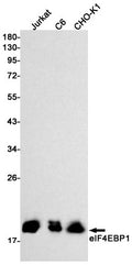 Recombinant 4E BP1 Monoclonal Antibody – Figure 1 of 3
