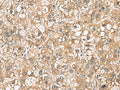 PTPRS Polyclonal Antibody – Figure 1 of 3