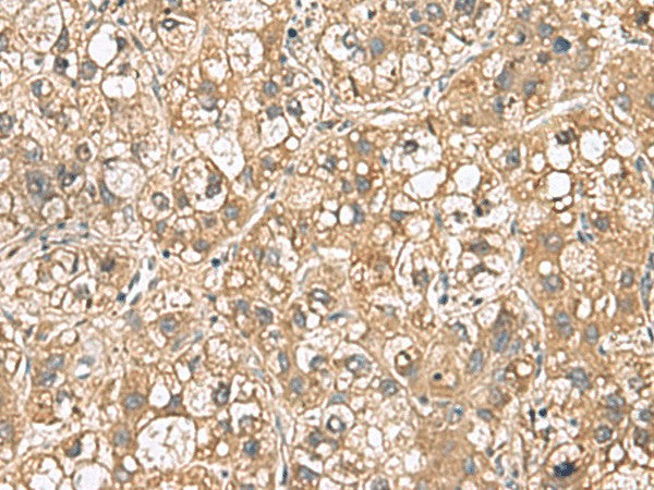 PTPRS Polyclonal Antibody – Figure 1 of 3