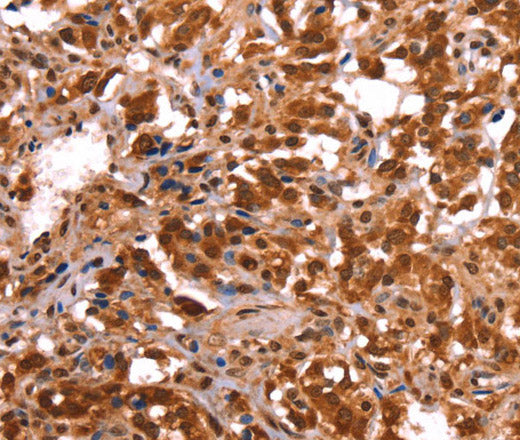 ESRRB Polyclonal Antibody – Figure 1 of 3