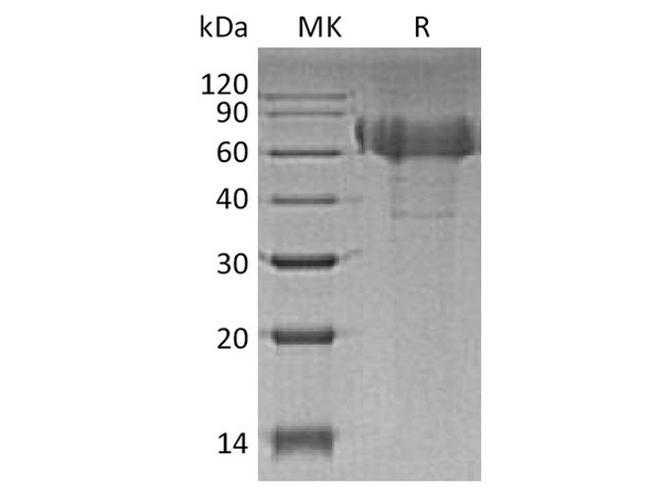 Recombinant Human TIM4/TIMD4 Protein (His Tag) – Figure 1 of 2