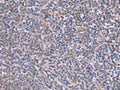 RIC3 Polyclonal Antibody – Figure 1 of 3