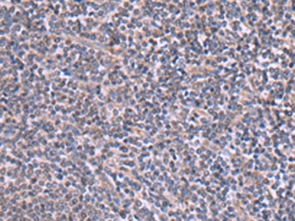 RIC3 Polyclonal Antibody – Figure 1 of 3
