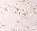 SCGB1A1 Polyclonal Antibody – Figure 1 of 2
