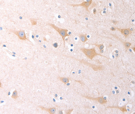 SCGB1A1 Polyclonal Antibody – Figure 1 of 2