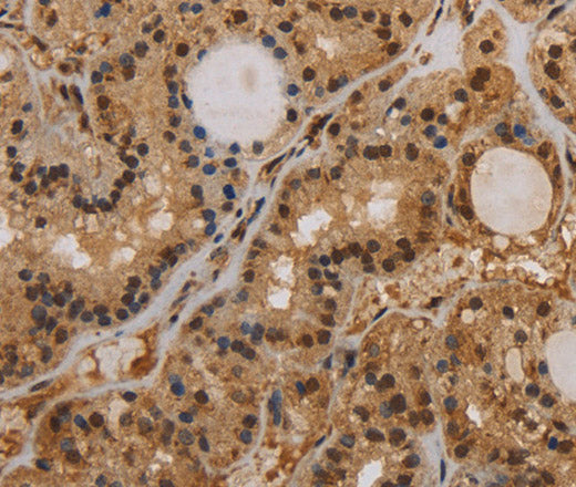 KCNN4 Polyclonal Antibody – Figure 1 of 3