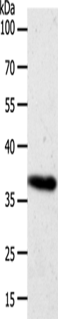 AKR1B1 Polyclonal Antibody – Figure 1 of 4