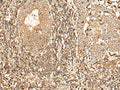 GALR2 Polyclonal Antibody – Figure 1 of 2
