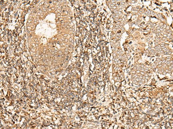 GALR2 Polyclonal Antibody – Figure 1 of 2