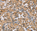 FLT3 Polyclonal Antibody – Figure 1 of 3