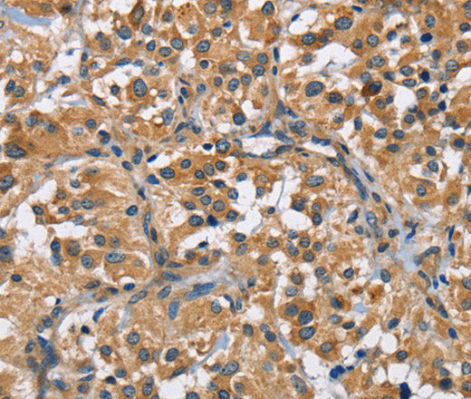 FLT3 Polyclonal Antibody – Figure 1 of 3