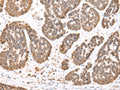 DDX58 Polyclonal Antibody – Figure 1 of 3