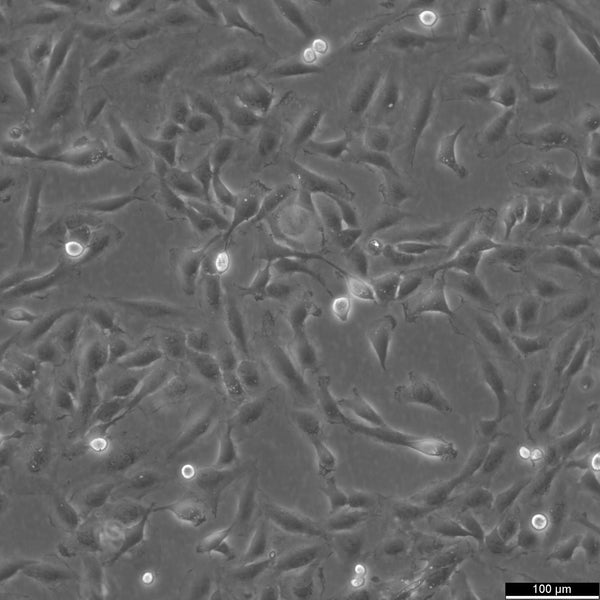 KTC-1 cell