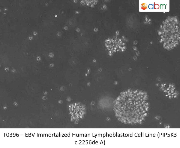 EBV Immortalized Human Lymphoblastoid Cell Line (PIP5K3 c.2256delA) | Applied Biological Materials (abm)