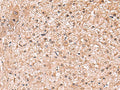 RUSC1 Polyclonal Antibody – Figure 1 of 3