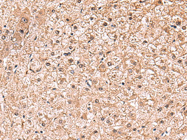 RUSC1 Polyclonal Antibody – Figure 1 of 3