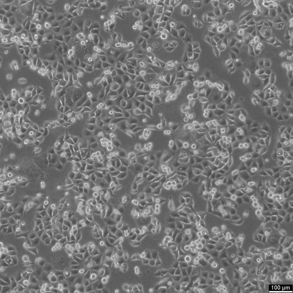 KYSE-30 cell