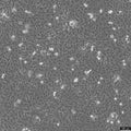 KYSE-410 cell