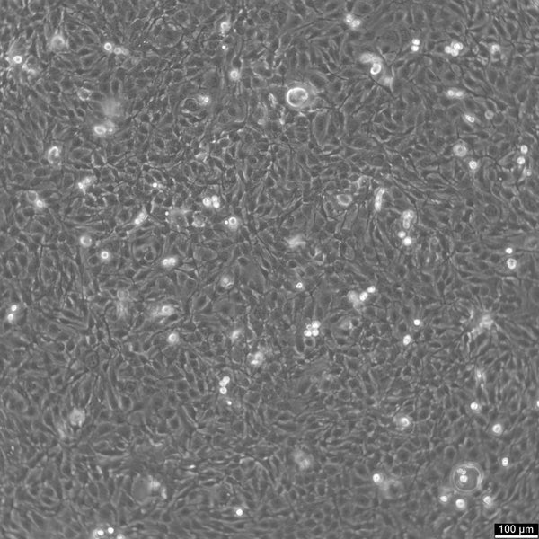 KYSE-410 cell